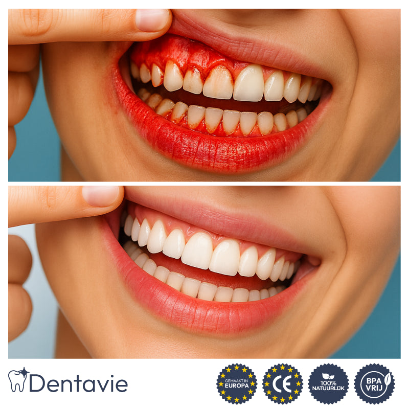 Dentavie Gel Restaurador de Encías – Revitaliza las encías y blanquea los dientes en 3 días