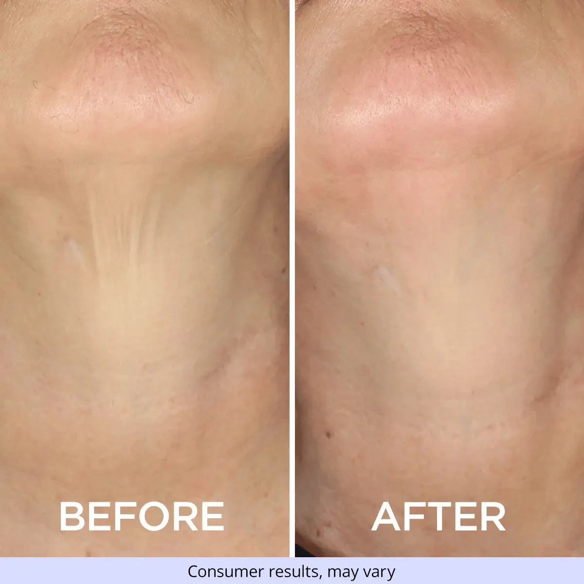 NECK PRODUCT